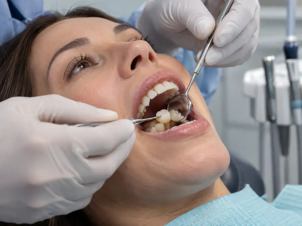 Dental Crowns treatments at Brush & Floss Dental Clinic Rawalpindi