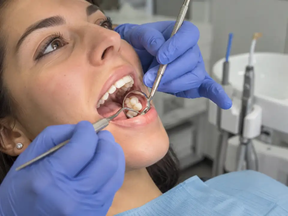 Dental Fillings treatments at Brush & Floss Dental Clinic Rawalpindi