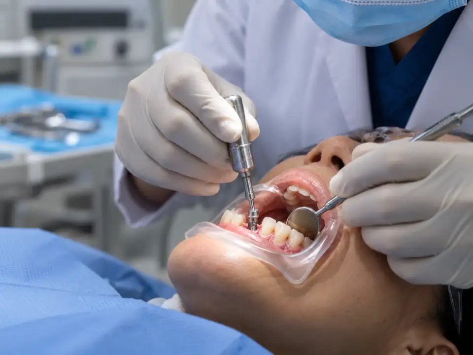 Dental Implants treatment at Brush & Floss Dental Clinic Rawalpindi