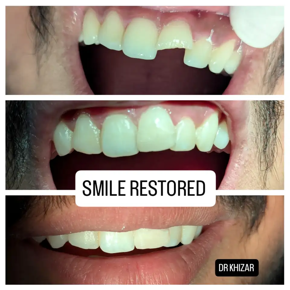 Before and after treatment result