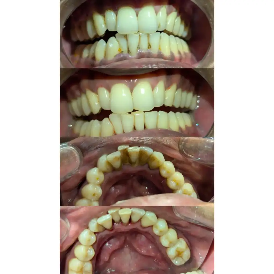 Before and after treatment result